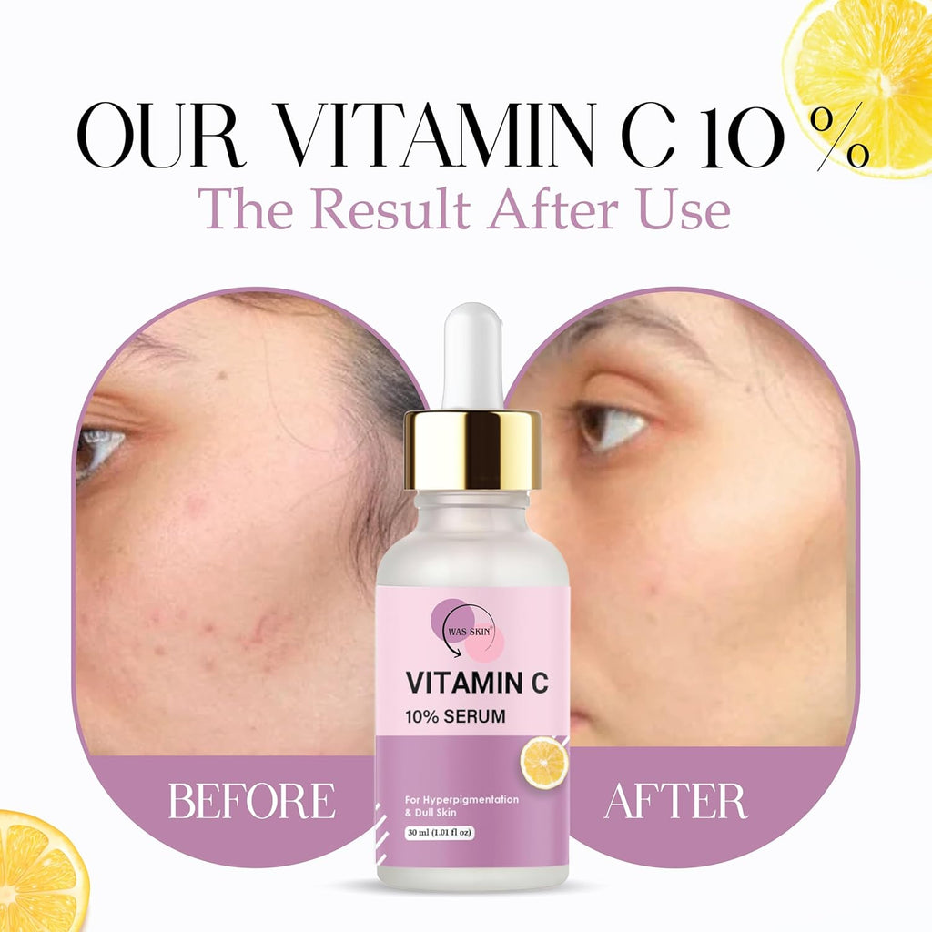 WAS SKIN Vitamin C 10% Serum for Skin Brightening, 30 ml