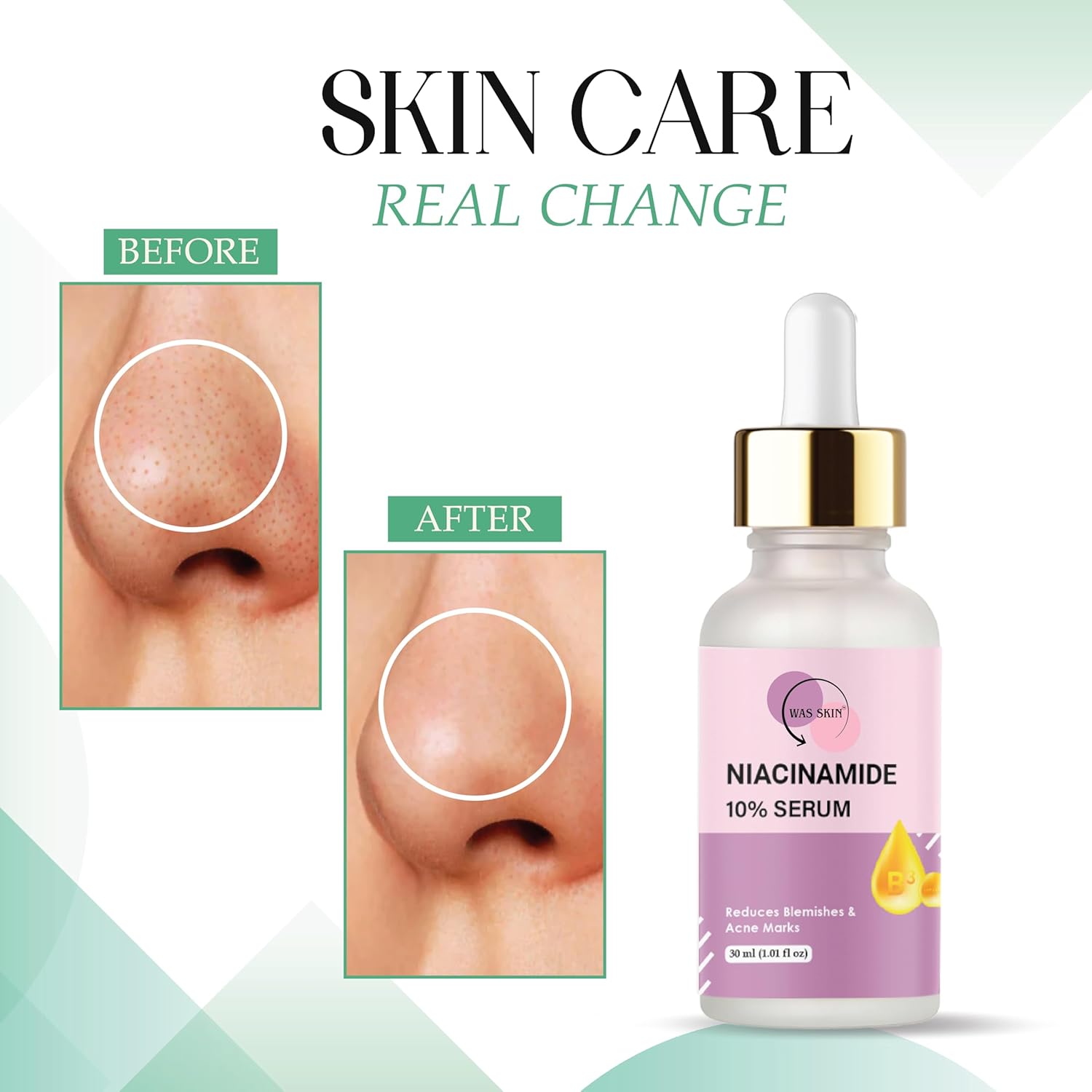 WAS SKIN Niacinamide 10% Serum, Reduces Blemishes and Acne Marks, Minimises Pores, Lightens Pigmentation, Natural Glow, 30 ml