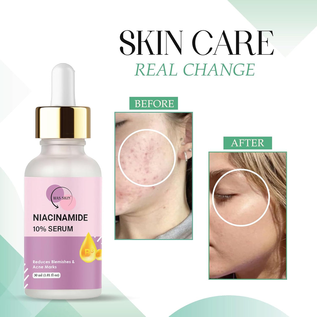 WAS SKIN Niacinamide 10% Serum, Reduces Blemishes and Acne Marks, Minimises Pores, Lightens Pigmentation, Natural Glow, 30 ml