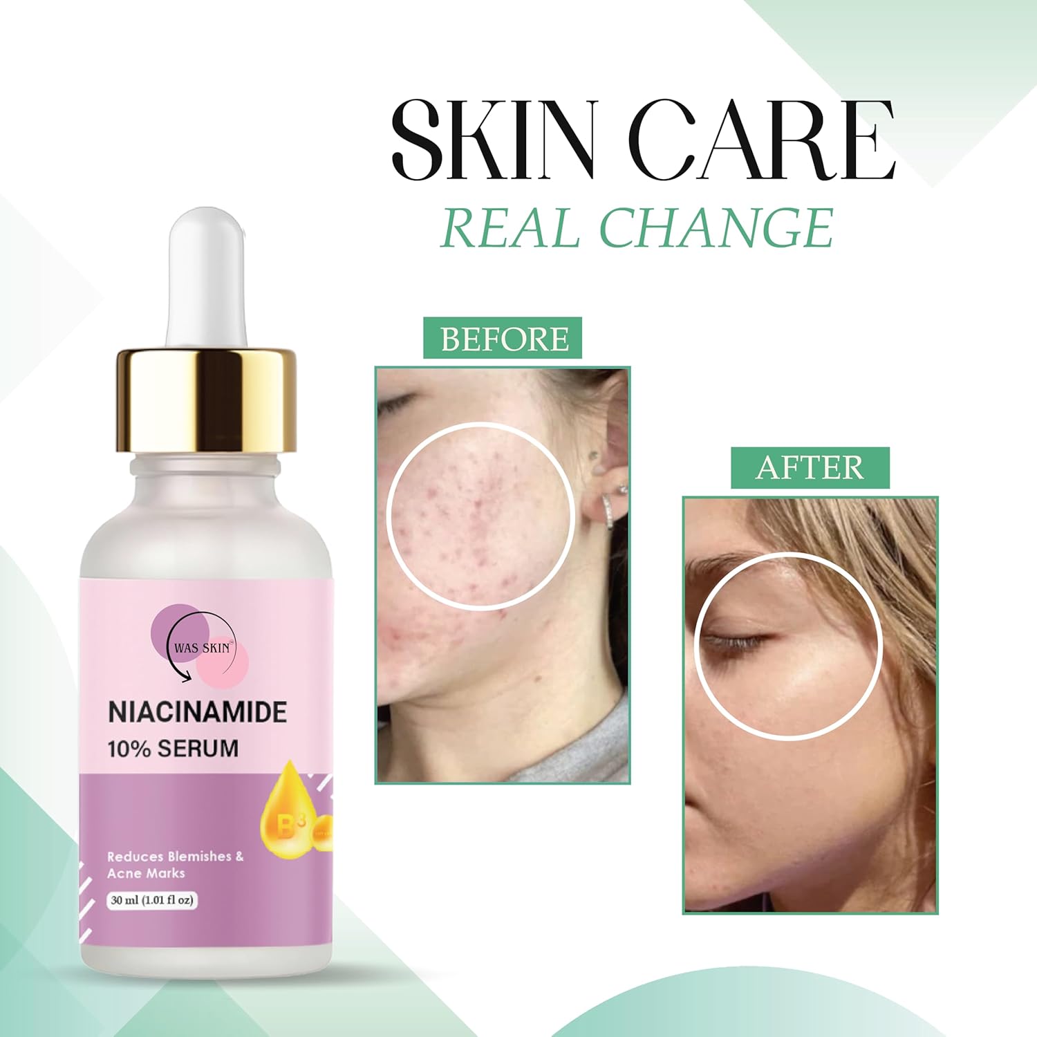 WAS SKIN Niacinamide 10% Serum, Reduces Blemishes and Acne Marks, Minimises Pores, Lightens Pigmentation, Natural Glow, 30 ml