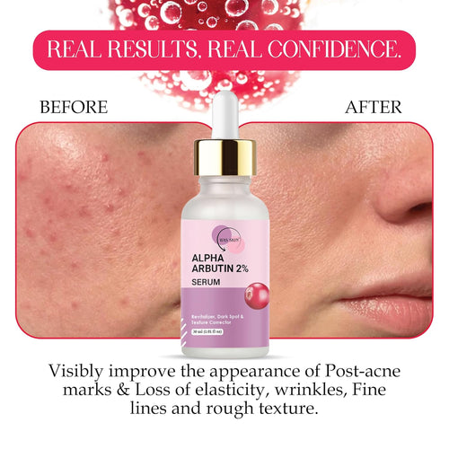WAS SKIN Alpha Arbutin 2% Serum with Hyaluronic Acid, Dark Spot and Texture Corrector, Revitaliser, 30 ml